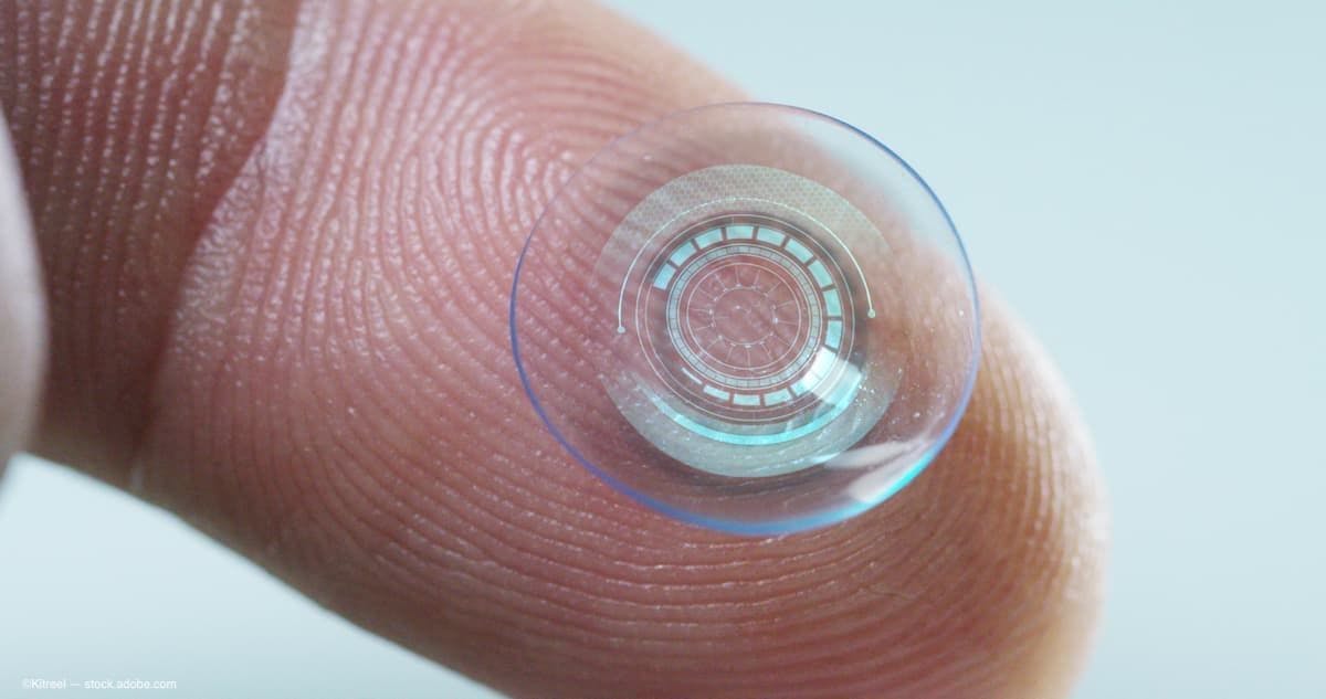 Researchers: ‘Smart’ contact lenses may one day enable wireless glaucoma detection