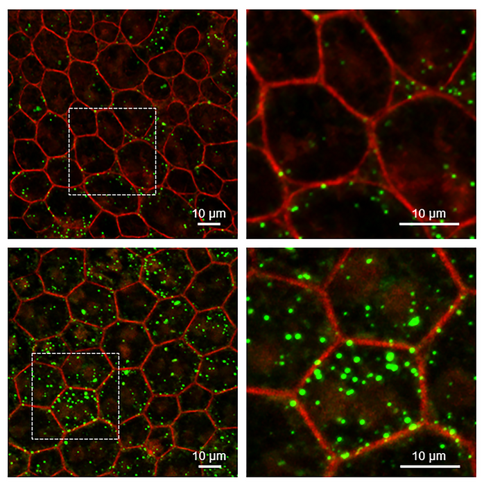 RPE from mice without Serpin1 accumulate more lipids than wild-type mice. Super-resolution confocal microscopy of RPE tissue from wild-type (upper) and Serpin1-null (lower) mice. Detailed images on the right are magnified regions of the RPE tissue imaged on the left (dotted square area). RPE cell boundaries are stained in red, and accumulated lipids are stained in green. Image courtesy of Ivan Rebustini/NEI