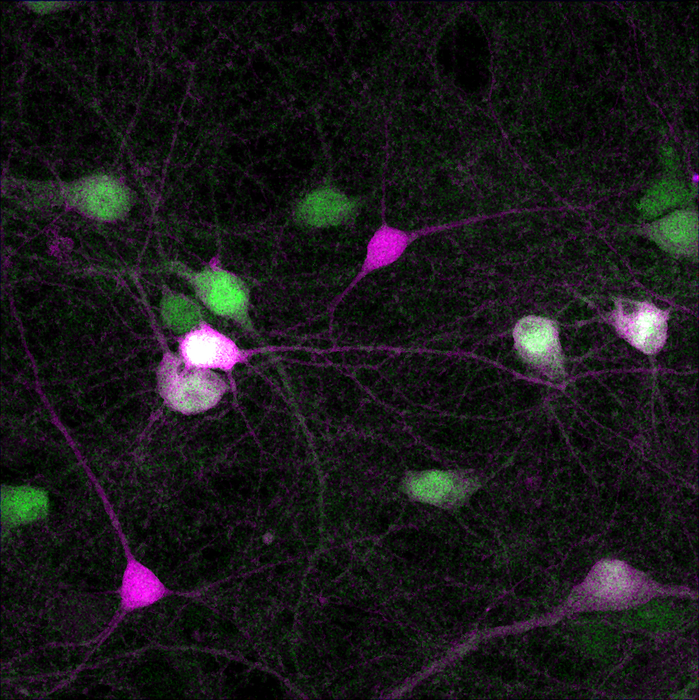 Excitatory/inhibitory neuronal reporter imaged in rat hippocampal neuronal cultures. (Image courtesy of Alexei Bygrave/Johns Hopkins Medicine)