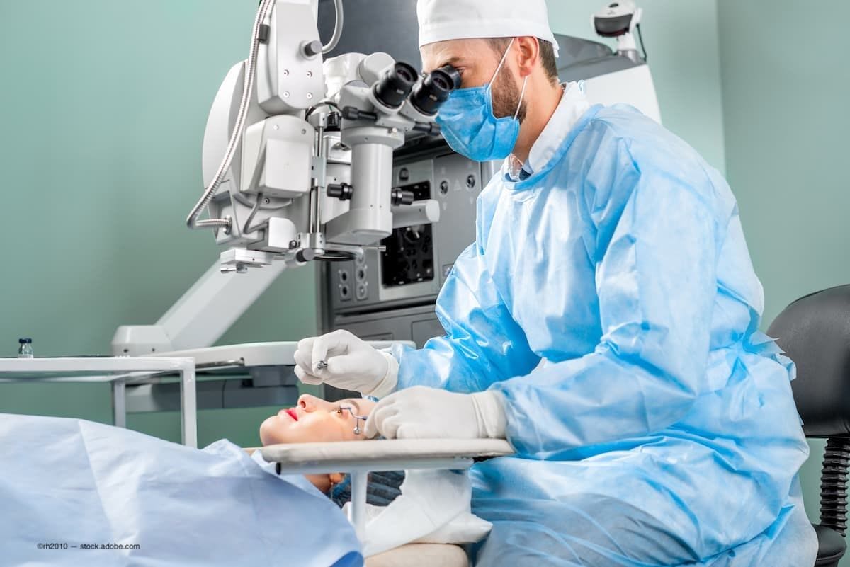 Smaller corneal incisions made during cataract surgery are linked with a better visual outcome and less frequent postoperative endophthalmitis. (Image courtesy stock.adobe.com)