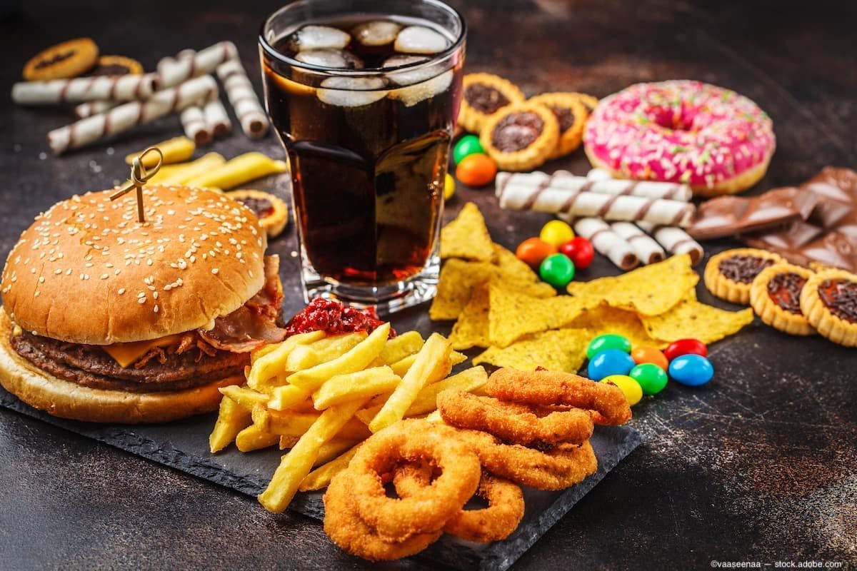 Study evaluates the potential correlation of ultra-processed food consumption and increased glaucoma incidence