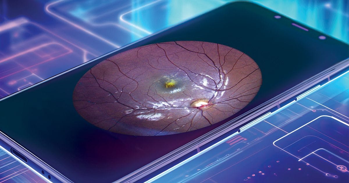 The role of multimodal imaging in ocular trauma