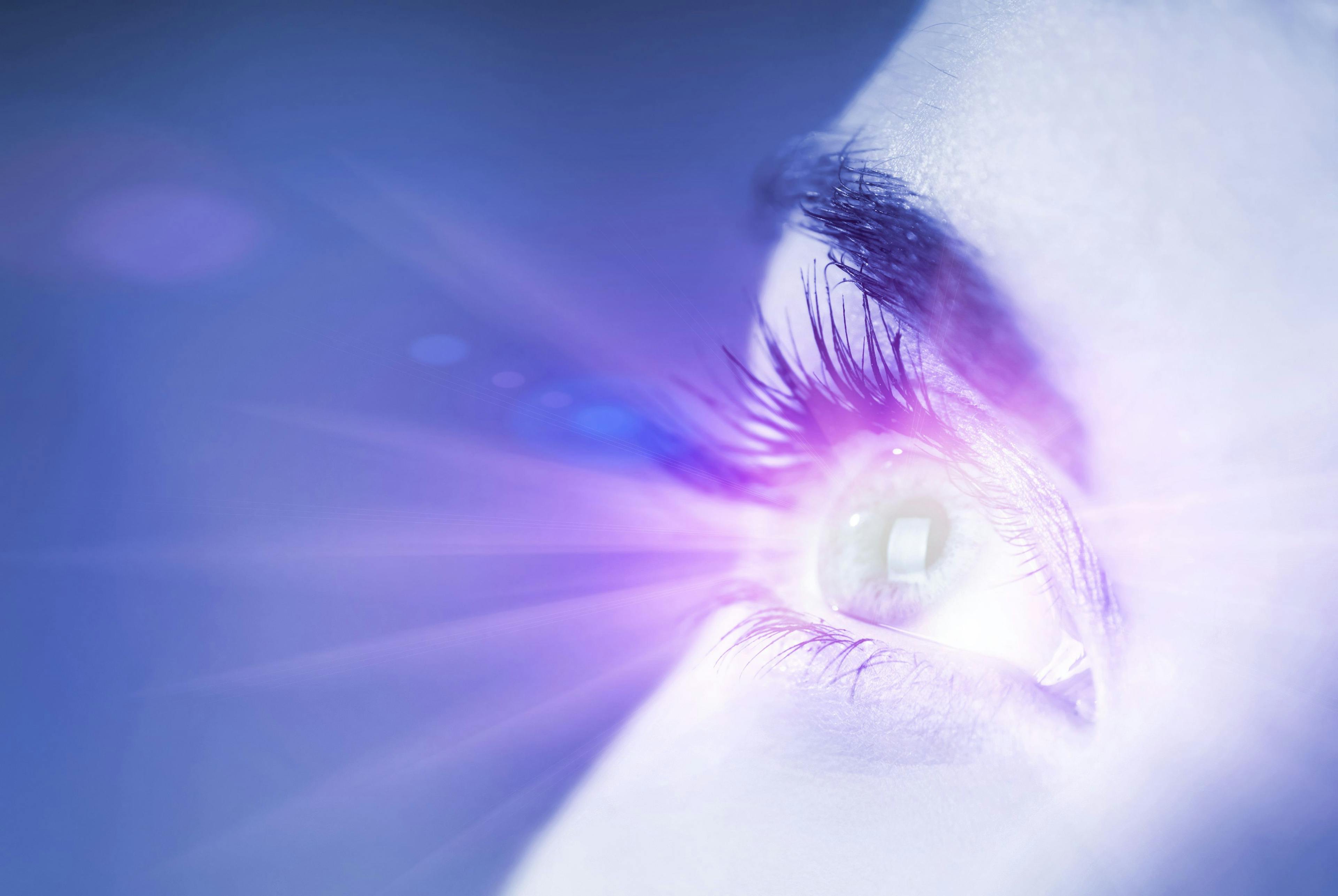 The ViaLase Laser combines a femtosecond laser and micron-level, high-definition image guidance to deliver a noninvasive glaucoma treatment called femtosecond laser image-guided, high-precision trabeculotomy, or FLigHT. (Image courtesy of Adobe Stock/Nejron)