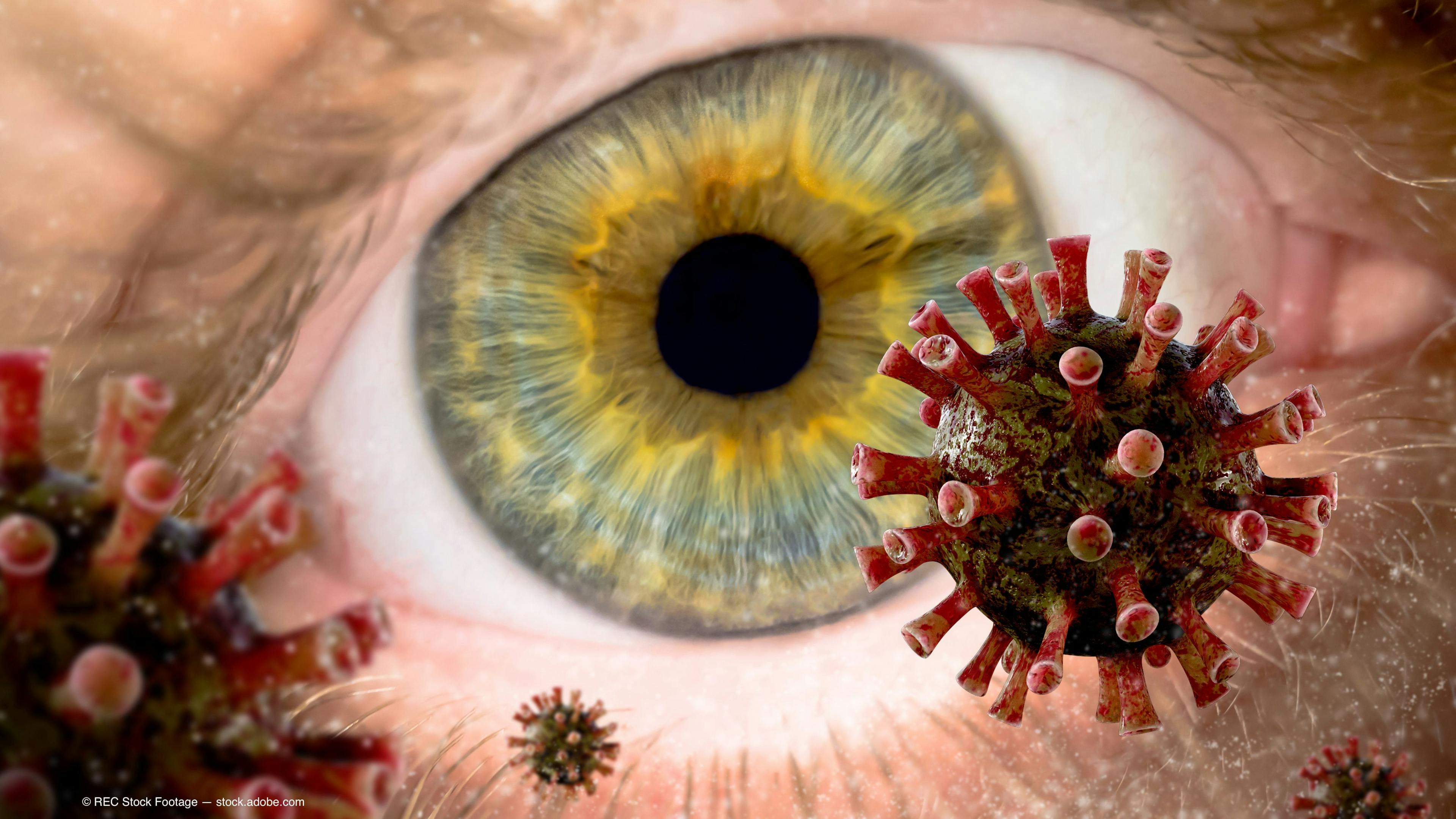 Investigators study ocular adverse events linked to inactivated COVID-19 vaccine