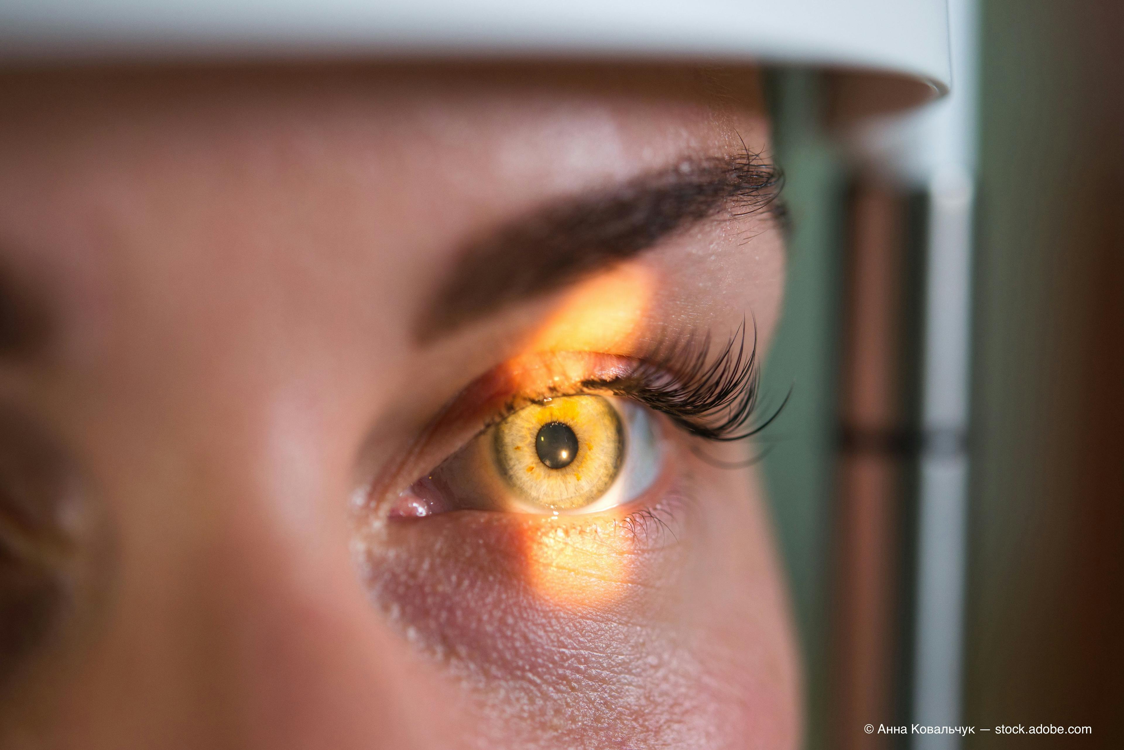 Reshaping medical treatment of glaucoma management 