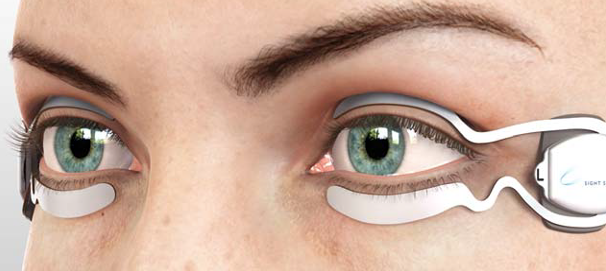 SmartLid devices are applied to the eyelids.