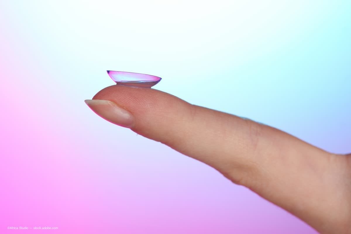 Azalea Vision announces first on-eye test of its smart contact lens prototype