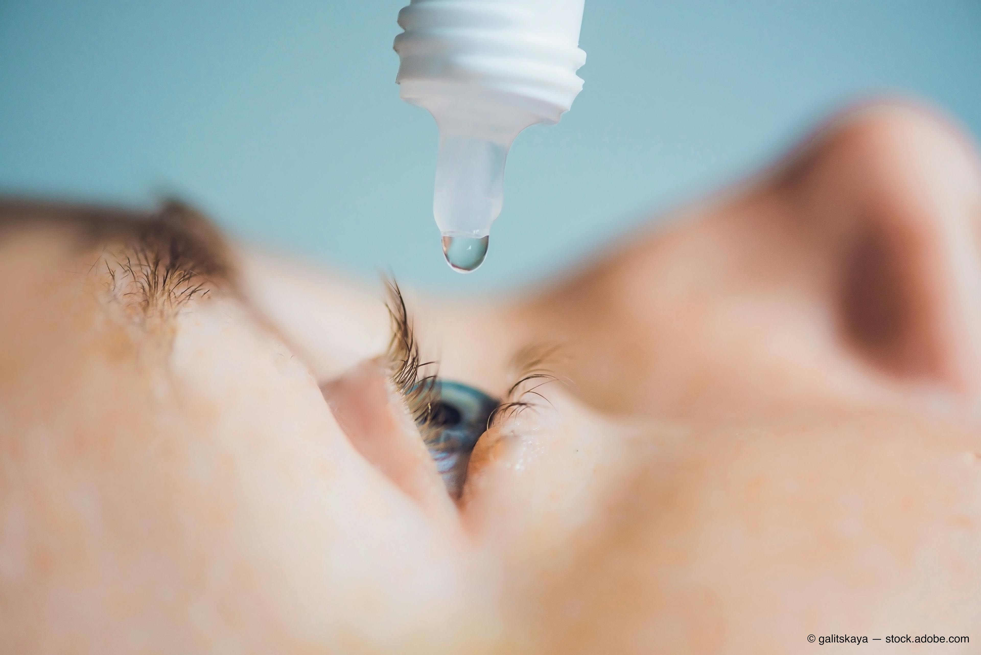 Company files international patent application for dry eye disease treatment