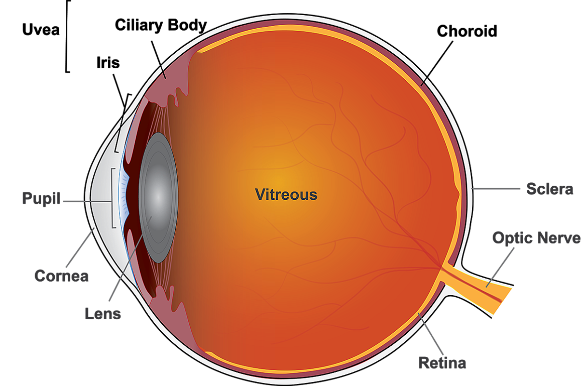 Uveitis is inflammation of the eye originating in the uvea, which includes the iris, ciliary body, and choroid. (Image courtesy of NEI/Lesley Earl)