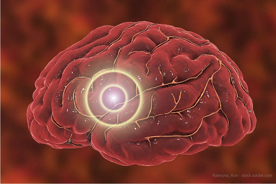 Therapies, trends make waves in neuro-ophthalmology 