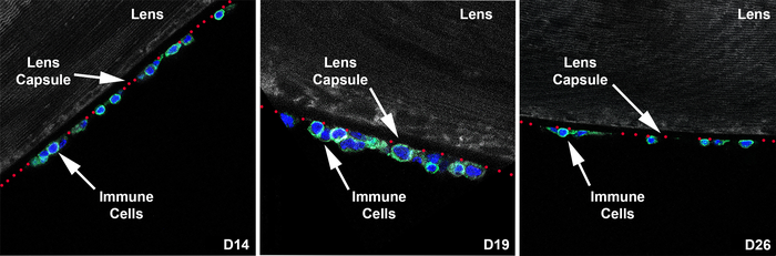 Immune cells on the surface of the eye. (Image courtesy of DeDreu et al., 2021)