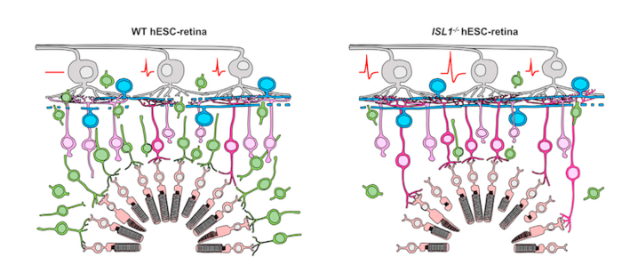 

Schematic showing the experimental results. Retinal sheets were grown from wild type human stem cells (left) or human stem cells missing the ISL1 gene (right). On the left, the transplanted photoreceptors (peach cells) are connected to transplanted bipolar cells (green) as part of the retinal sheet. On the right, the graft bipolar cells have died off, and the receptors connect to host bipolar cells (pink). The result is that all ganglion cells on the right respond to light, and responses are higher than those on the left. Photoreceptors (peach cells at the bottom) in the graft connect to bipolar cells (graft bipolar cells: green; host bipolar cells: pink). Host bipolar cells connect to host ganglion cells (top gray cells), which send axons to the brain as the optic nerve. recordings were made from the ganglion cells in response to light (red voltage trace). Image courtesy of Riken