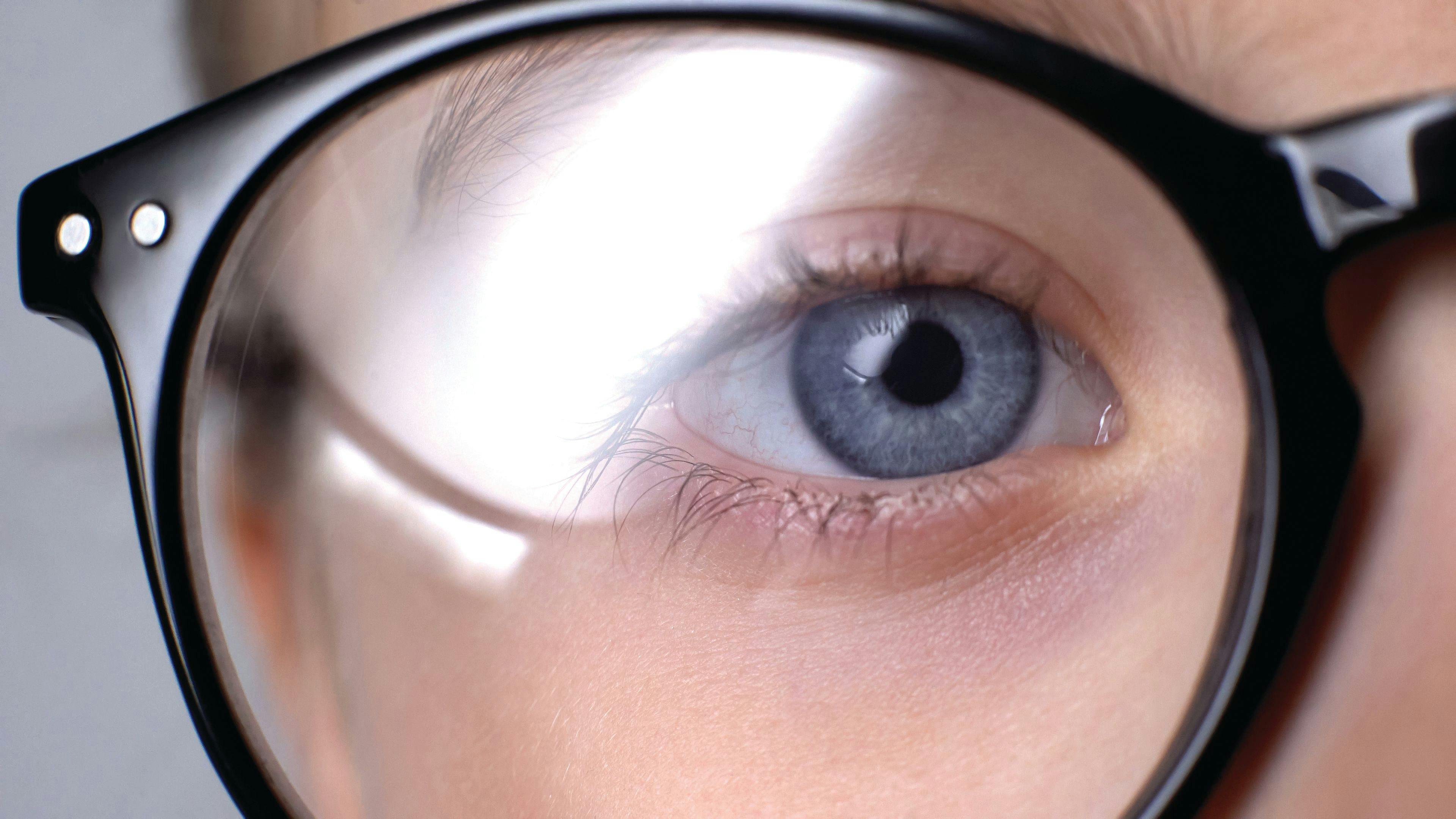 FDA grants clearance for myopia device