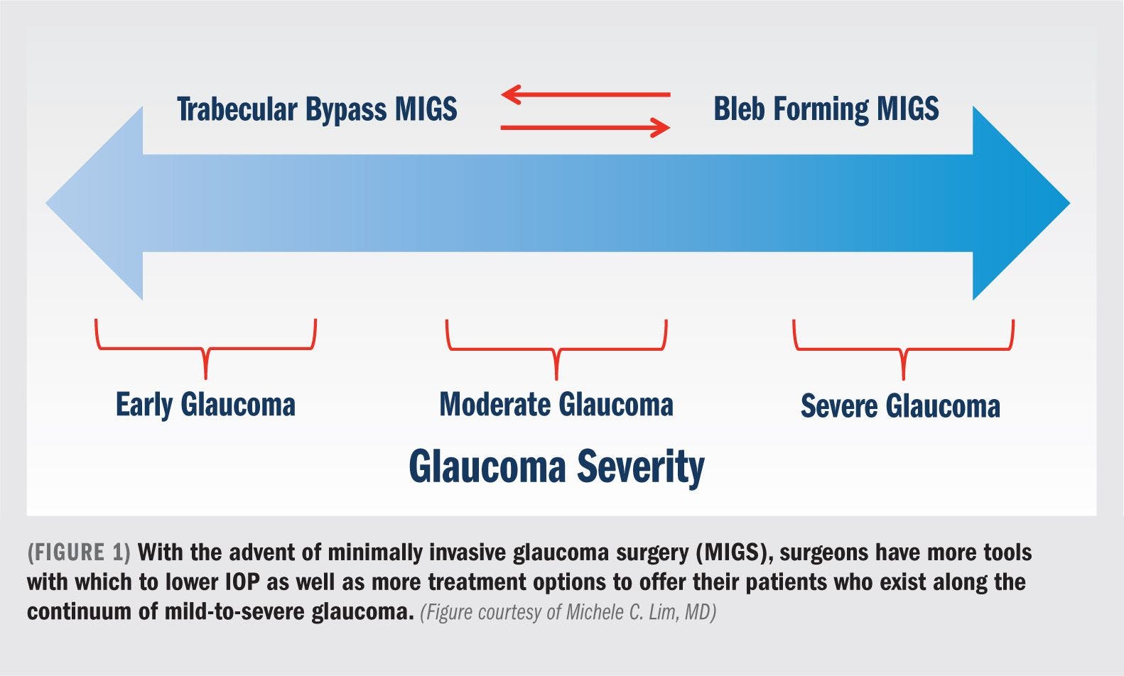 MIGS continues to innovate, secure place in glaucoma