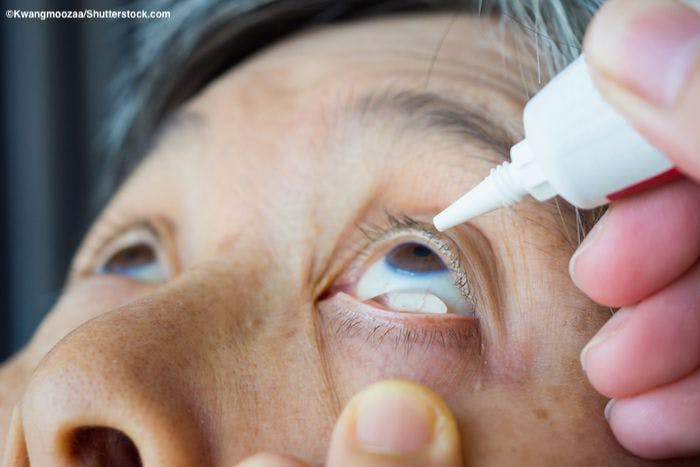 Treating presbyopia with an eye drop?