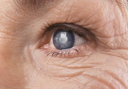 AEYE Health reports results of its AI algorithm for autonomous screening and detection of diabetic retinopathy