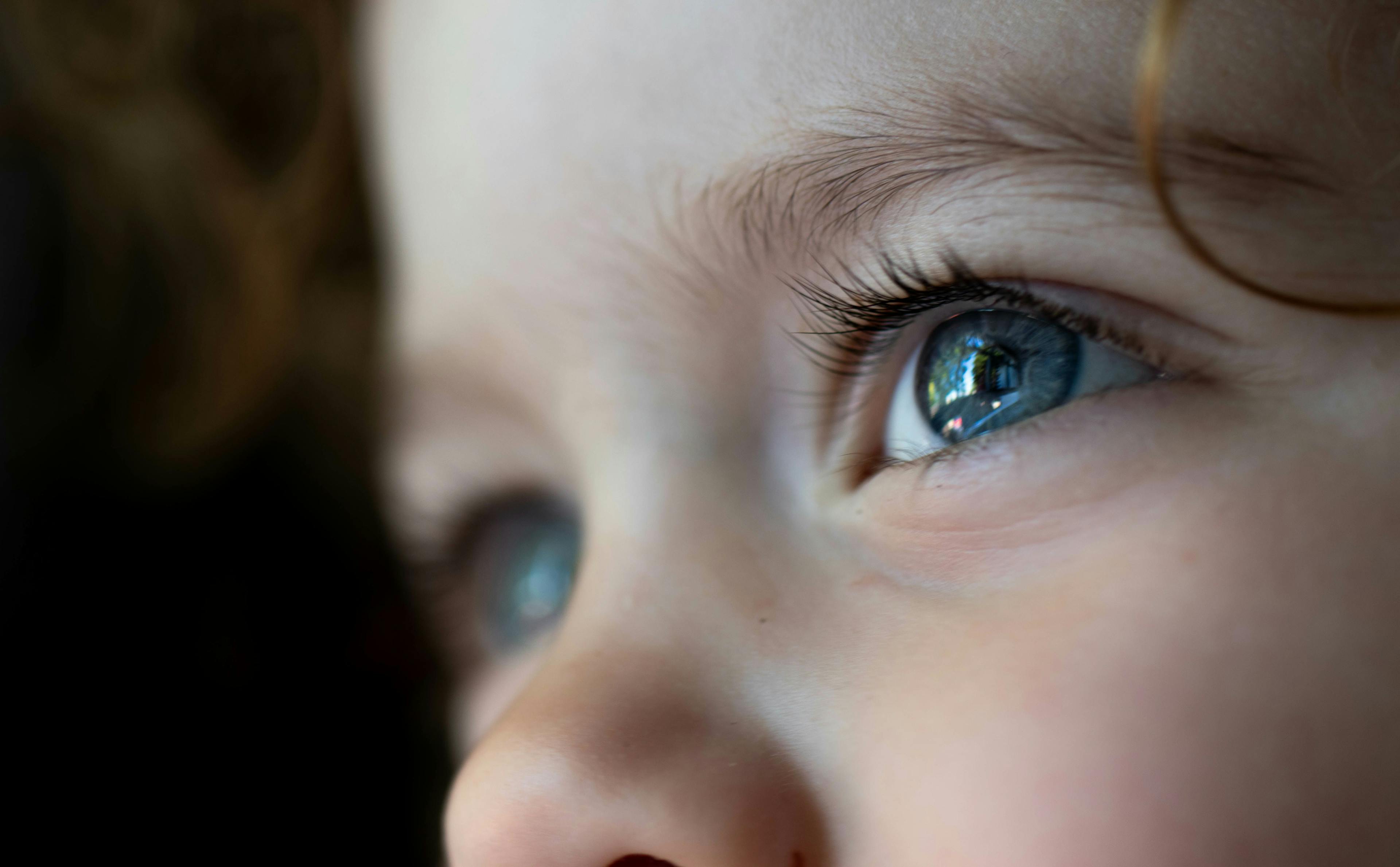 The CHAMP study has been designed, in collaboration with FDA, to evaluate whether NVK002 eye drops are safe and effective as a treatment for the progression of myopia in children. (Image courtesy of Adobe Stock)