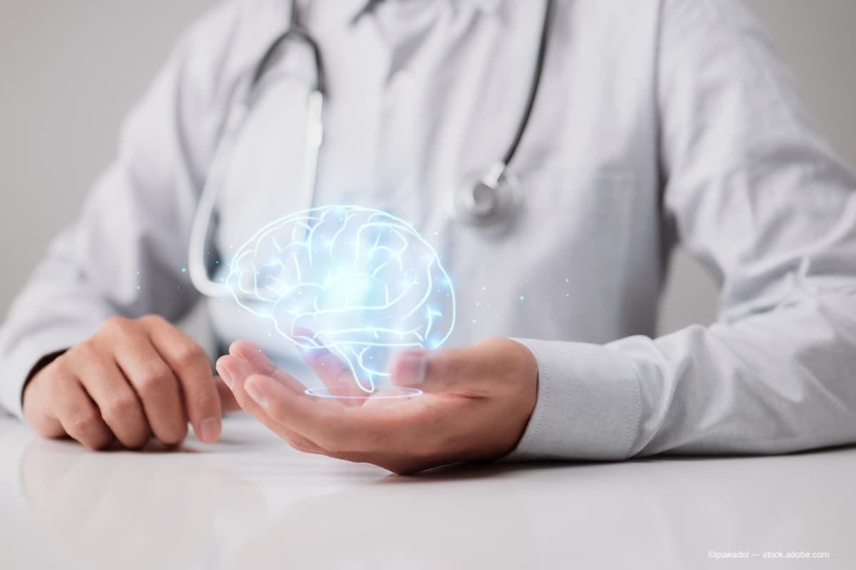 Doctor holding an image of the brain (Image Credit: AdobeStock/ipuwadol)