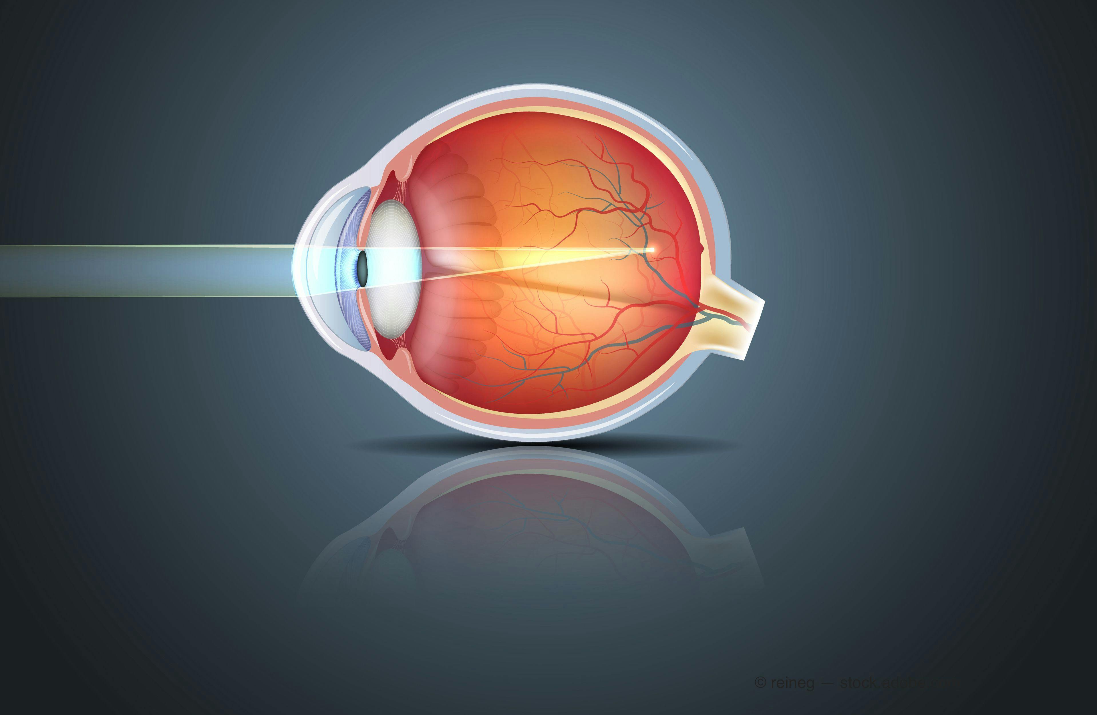 Nevakar announces formation of ophthalmic subsidiary, Vyluma