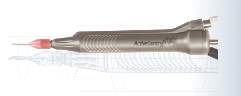 Active Sentry handpiece stabilizes IOP, anterior chamber during PEA surgery