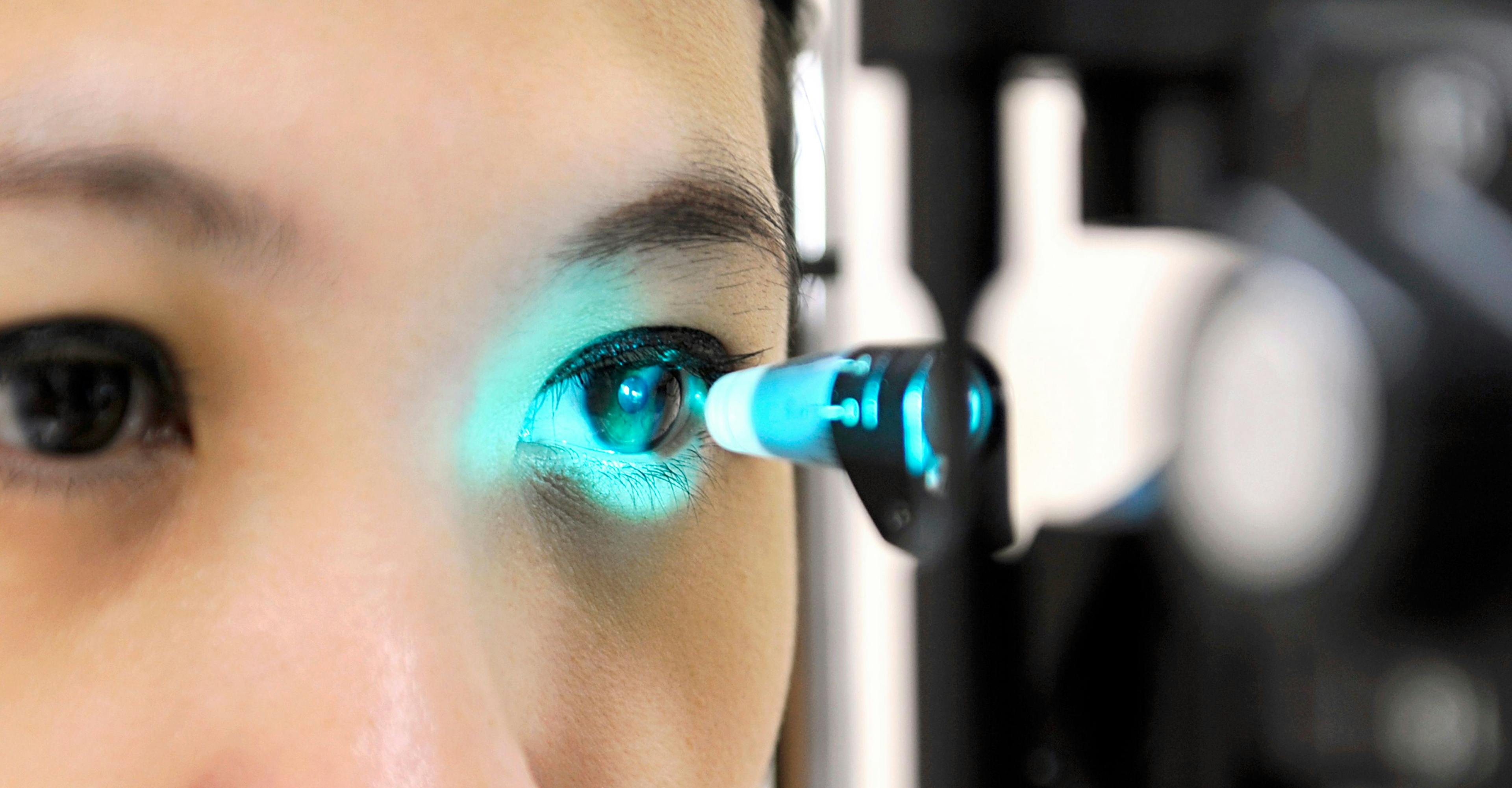 The company’s OCT-guided femtosecond laser technology is designed to perform the first femtosecond laser, image-guided, high-precision trabeculotomy (FLigHT) procedure for the treatment of primary open-angle glaucoma (POAG).