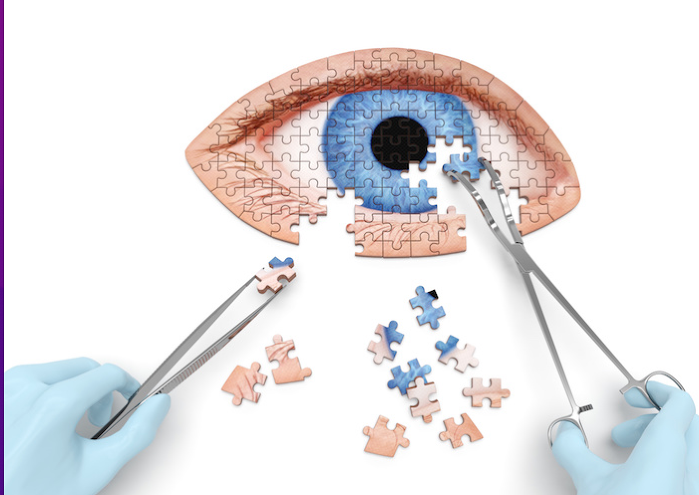 Study: Atropine drops after glaucoma surgery may impair vision, prolong rehabilitation