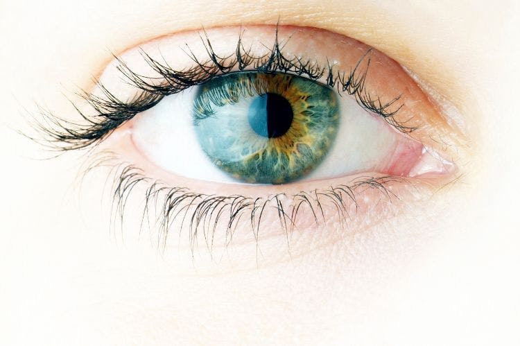 Intraocular corticosteroid a step forward for postop inflammation