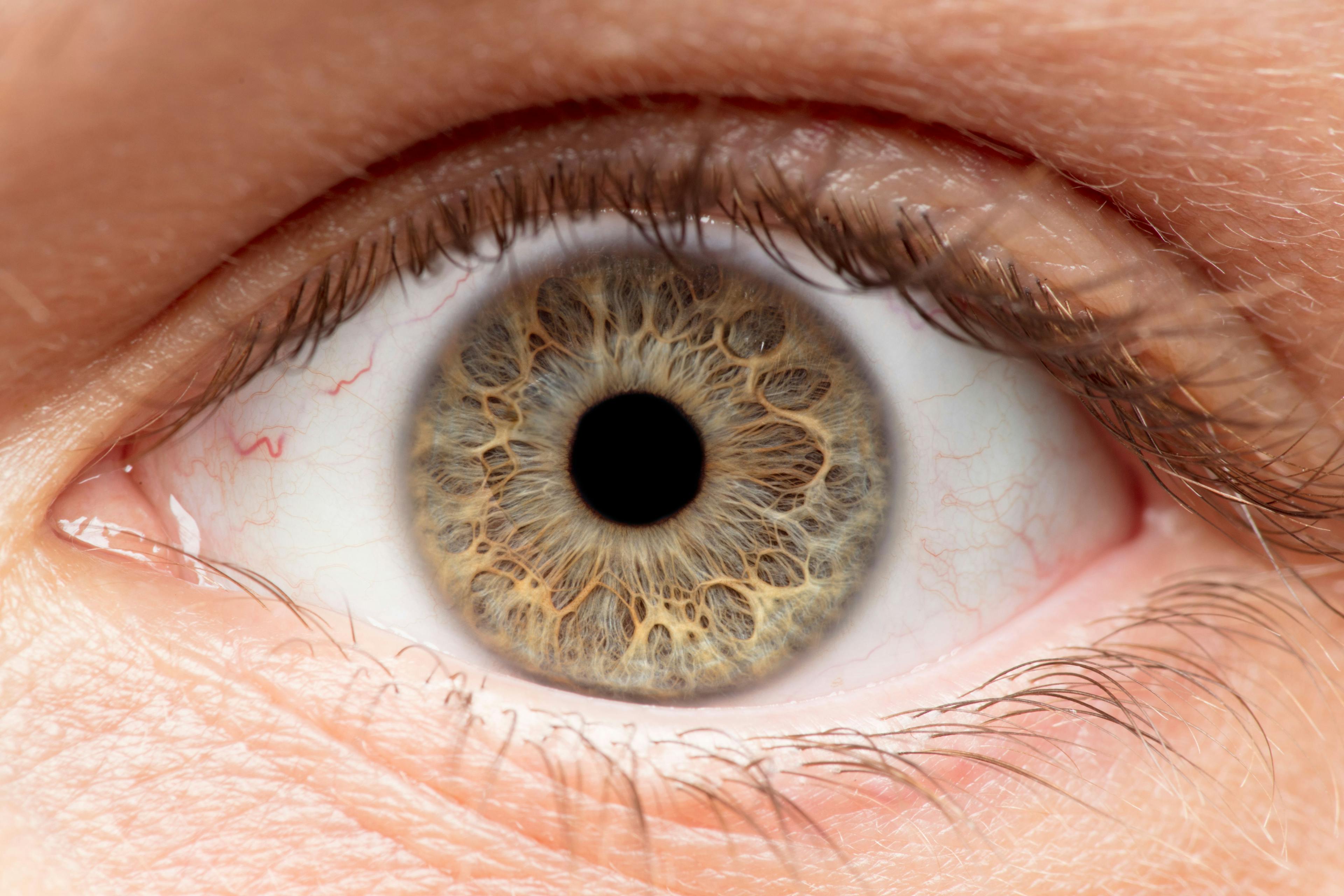 Study: Eye color genes are critical for retinal health