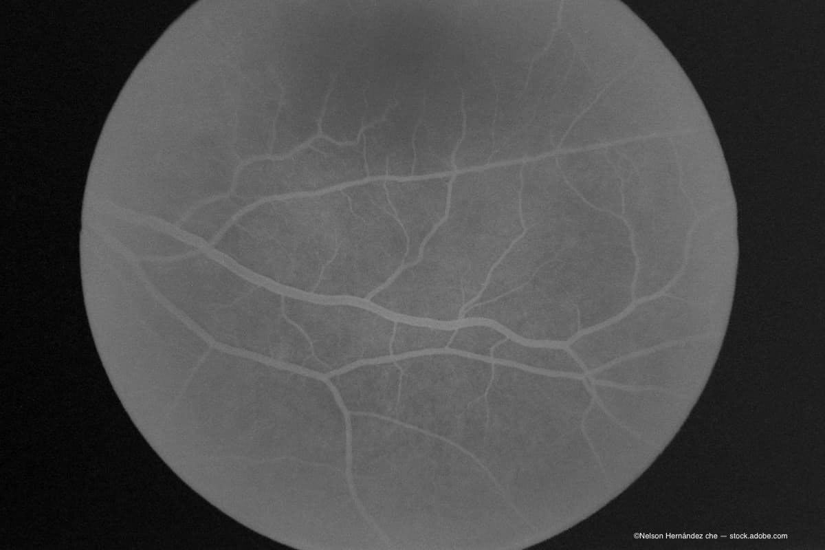 angiography of the eye. (Image Credit: AdobeStock/Nelson Hernández che)