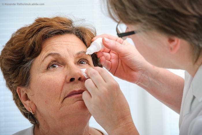 Eliminating nonadherence: Leaving the glaucoma drops in the dust 