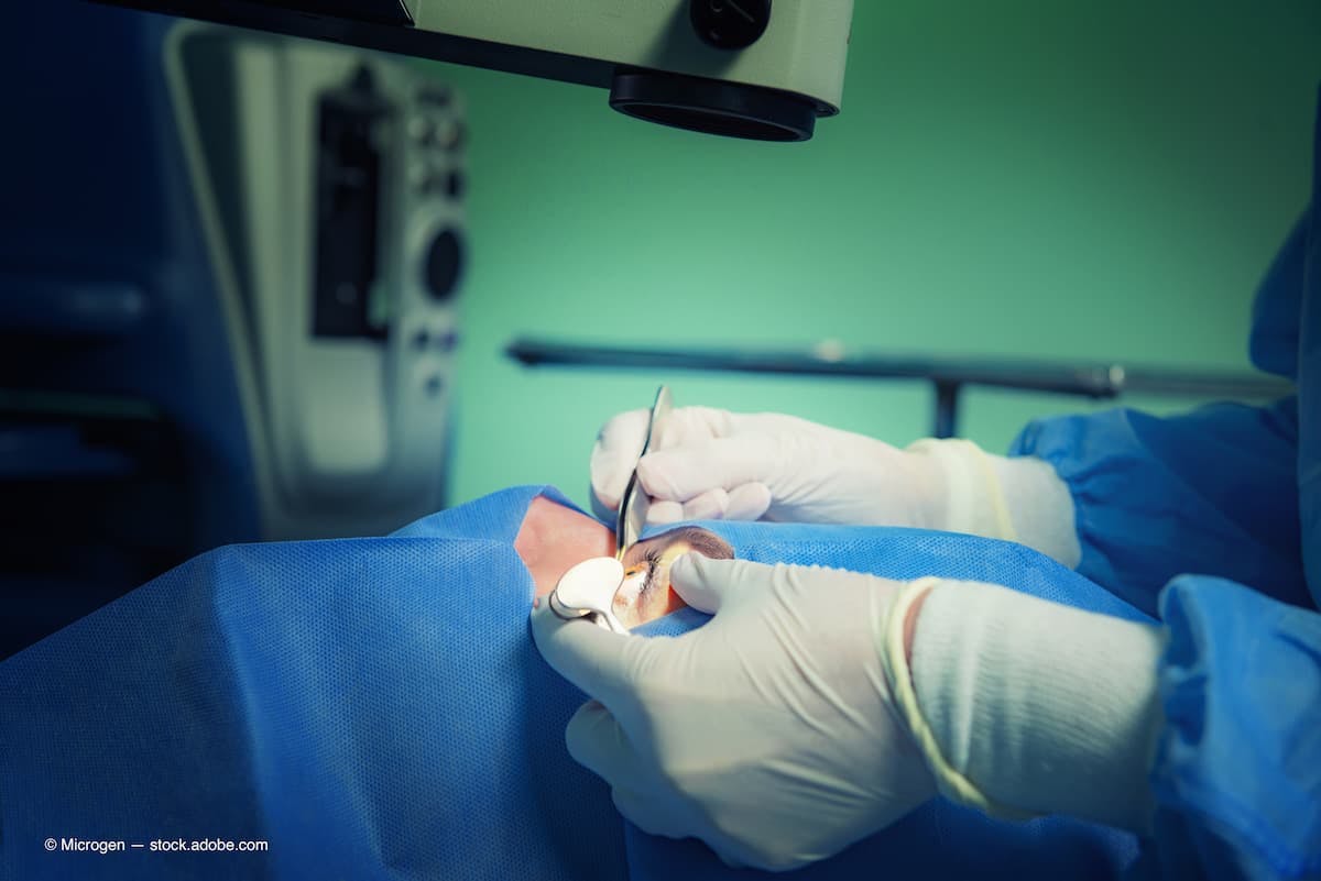 iSTAR Medical continues market expansion with first MINIject® surgeries in the UK 