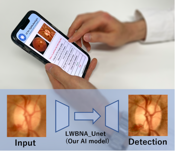 AI for the eye. The developed lightweight model precisely and rapidly detects image abnormalities related to diseases of the eye. The model is expected to provide accurate analysis on mobile devices/low CPU-GPU resource single board computers used in standalone self-monitoring devices. (Image courtesy of Parmanand Sharma, PhD)
