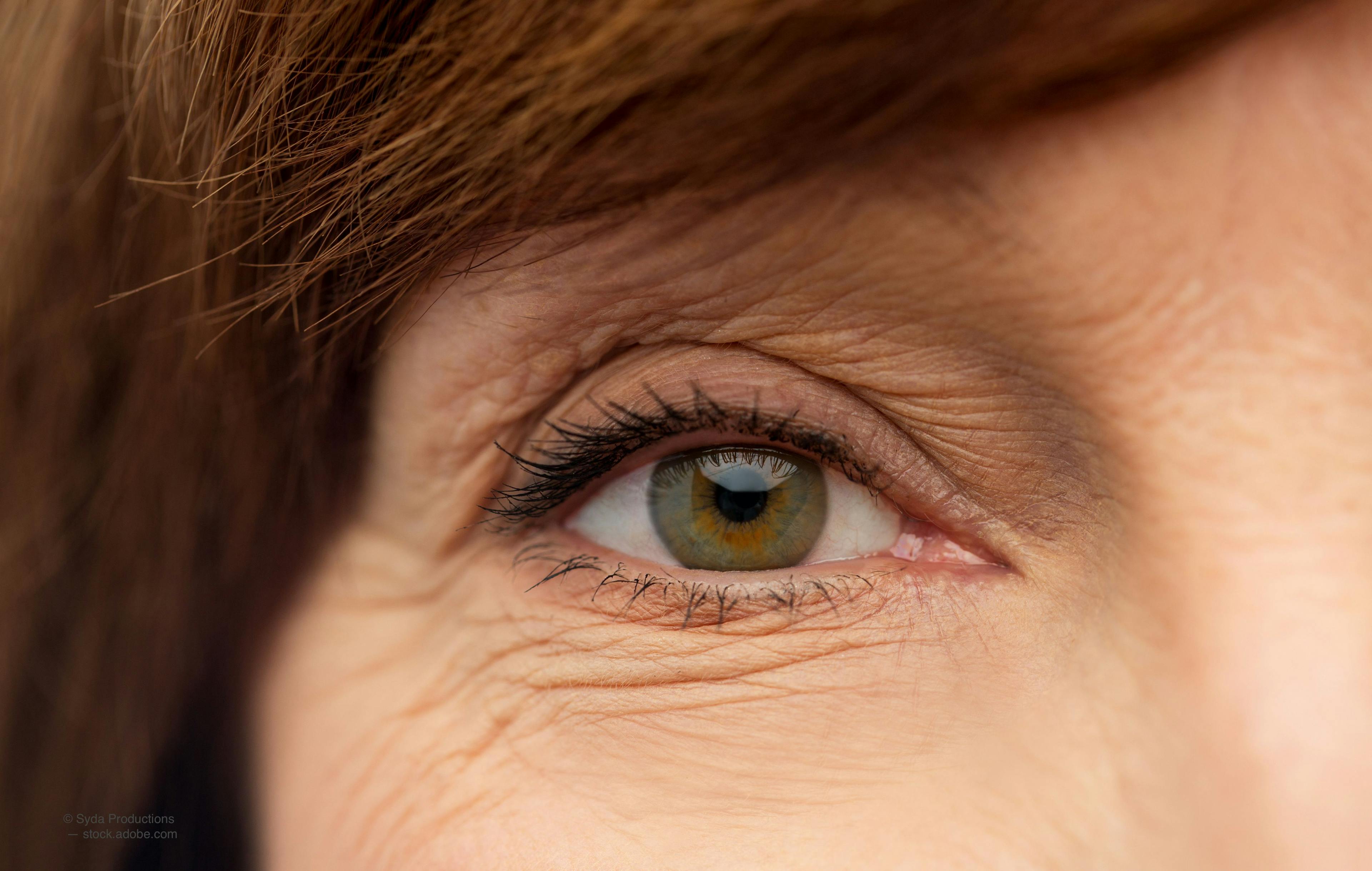 Study targets dry eye disease in postmenopausal women