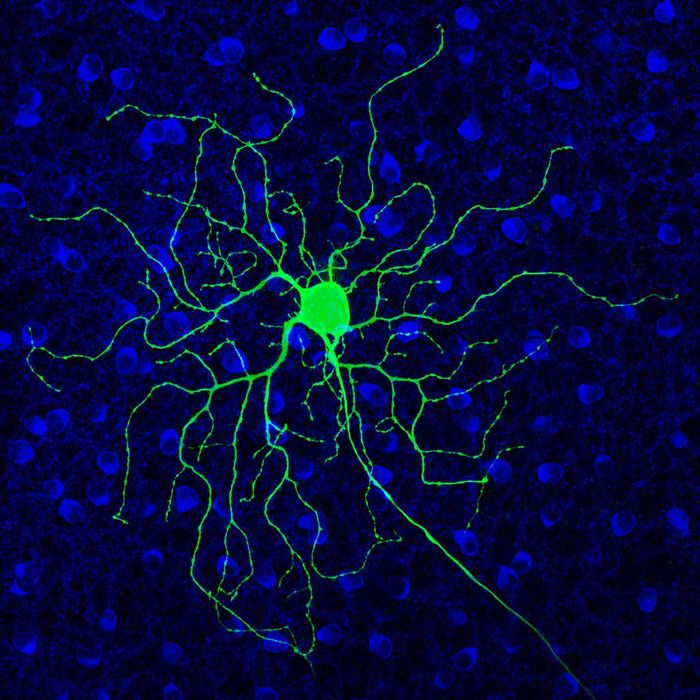 A mouse retinal ganglion cell (green), which becomes hyperactive in degenerative vision disorders. Other retinal cell types are labeled in blue. Hyperactivity interferes with the proper transfer of signals from the retina to the brain. Richard Kramer's lab at UC Berkeley has discovered what causes hyperactivity and has identified drugs that interfere with the process, and by doing so, improve vision. (Image courtesy of Shubhash Yadav, Richard Kramer lab, UC Berkeley)