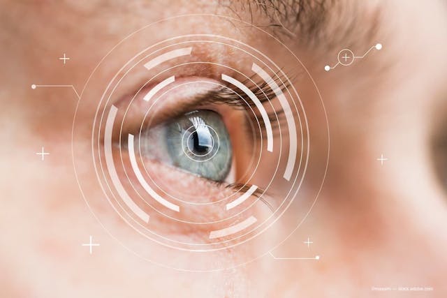 Tools can detect corneal  nerve damage early
