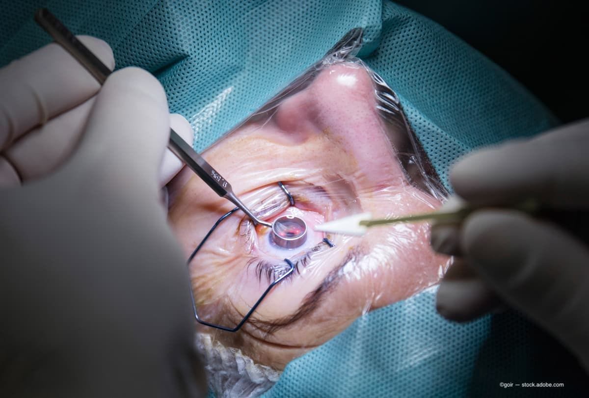 Integrated system streamlines cataract surgery
