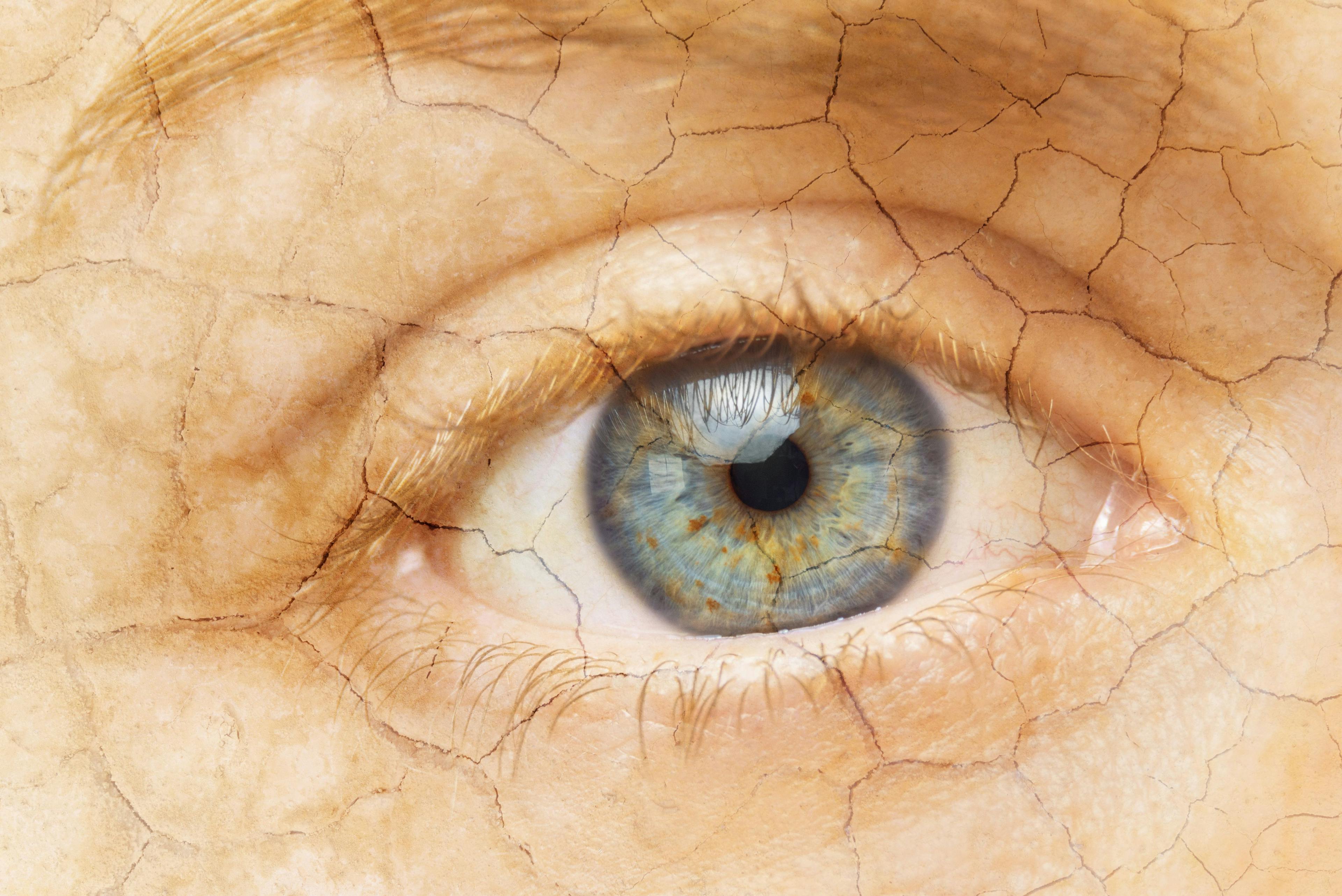 Allgenesis announces Phase 1b data showing AG-80308 providing improvements in dry eye patients