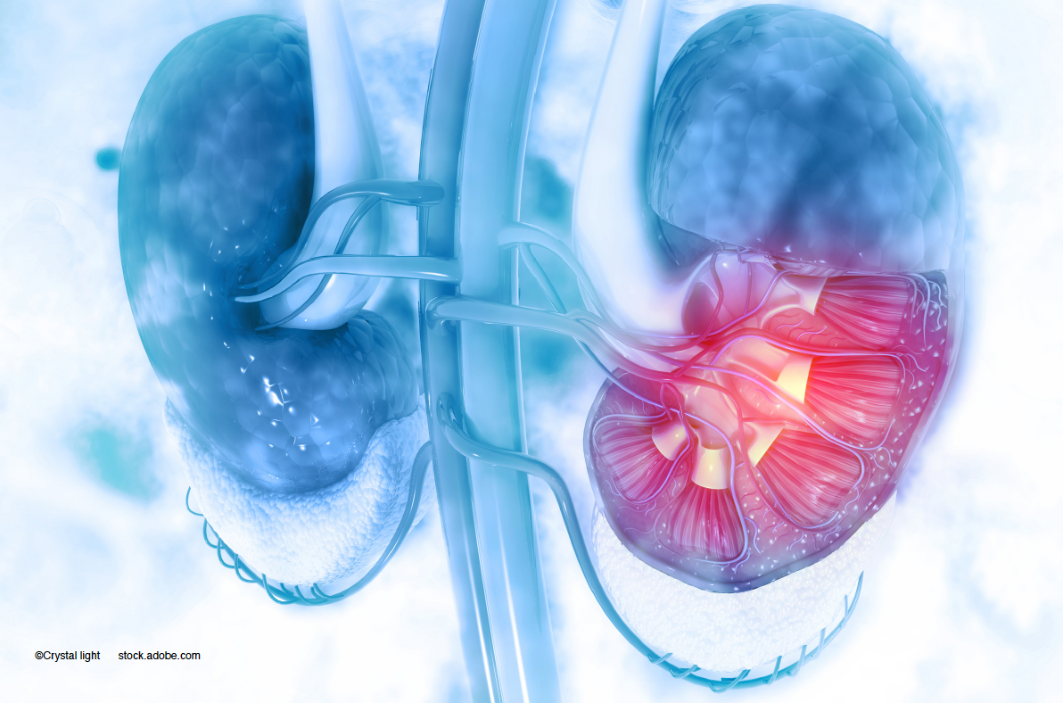How kidney function may play a role in DME treatment response