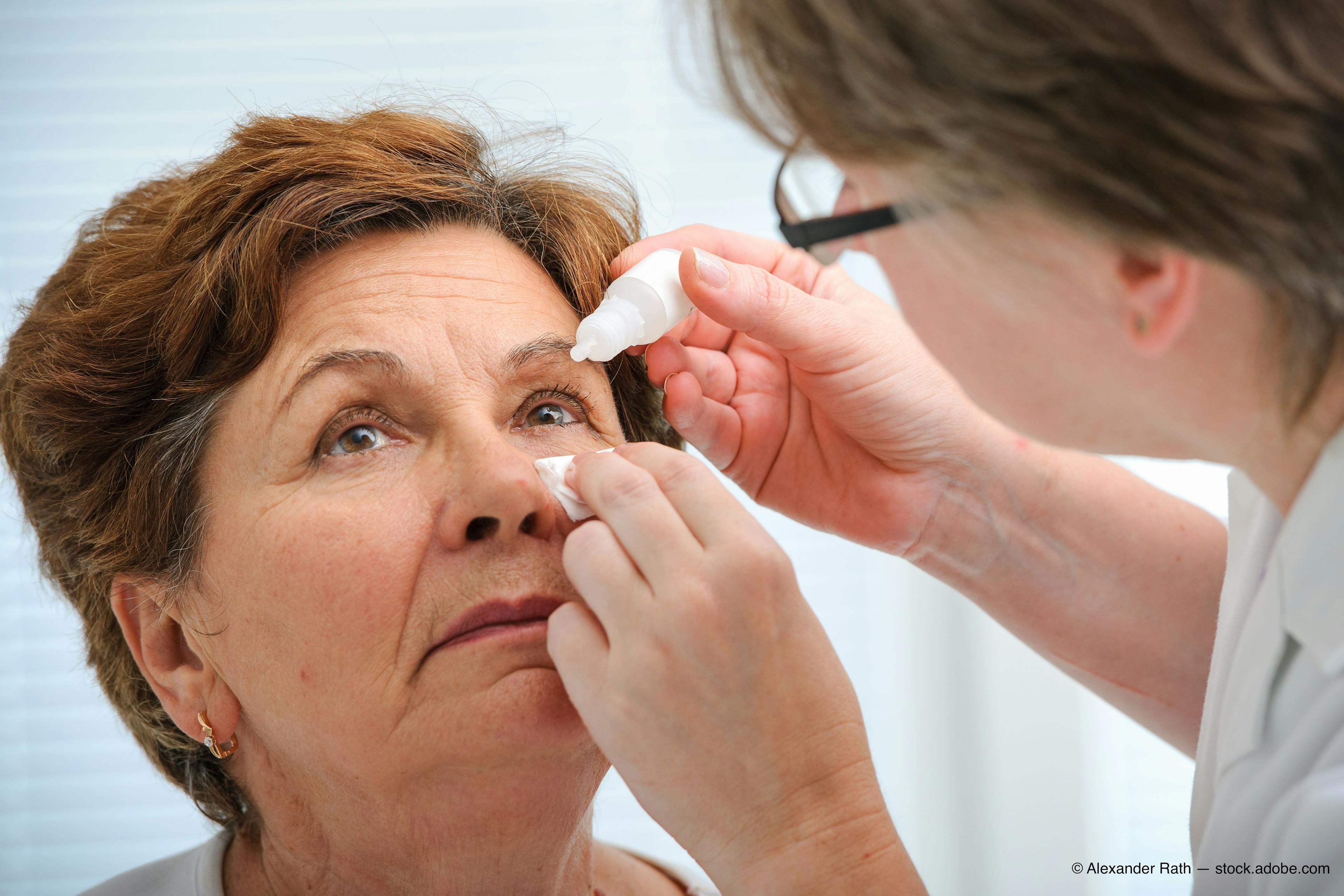 FDA approves eye drops for treatment of presbyopia