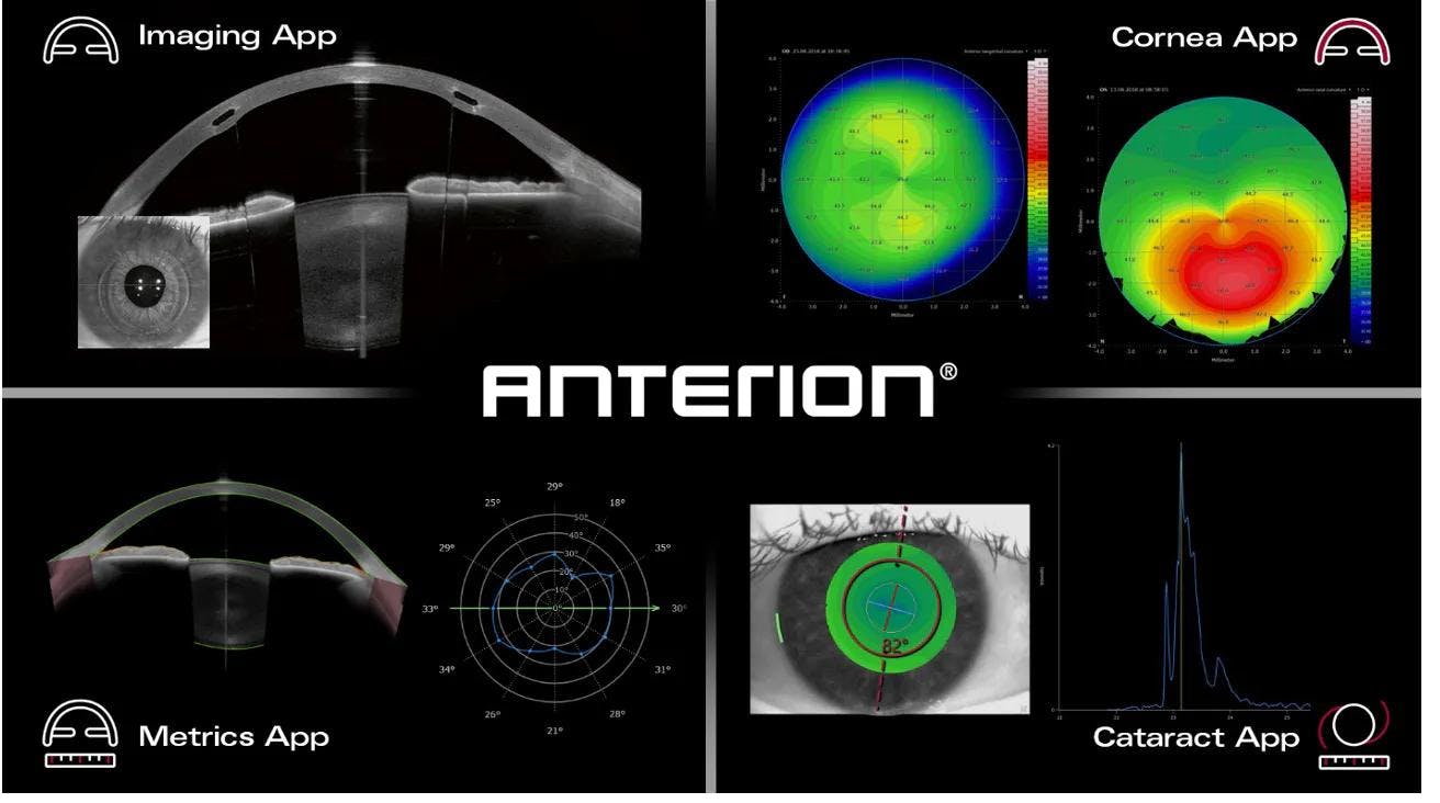 The ANTERION will work in conjunction with FDA-approved apps for imaging, metrics, cornea and cataract care. Image courtesy of Heidelberg Engineering GmbH.