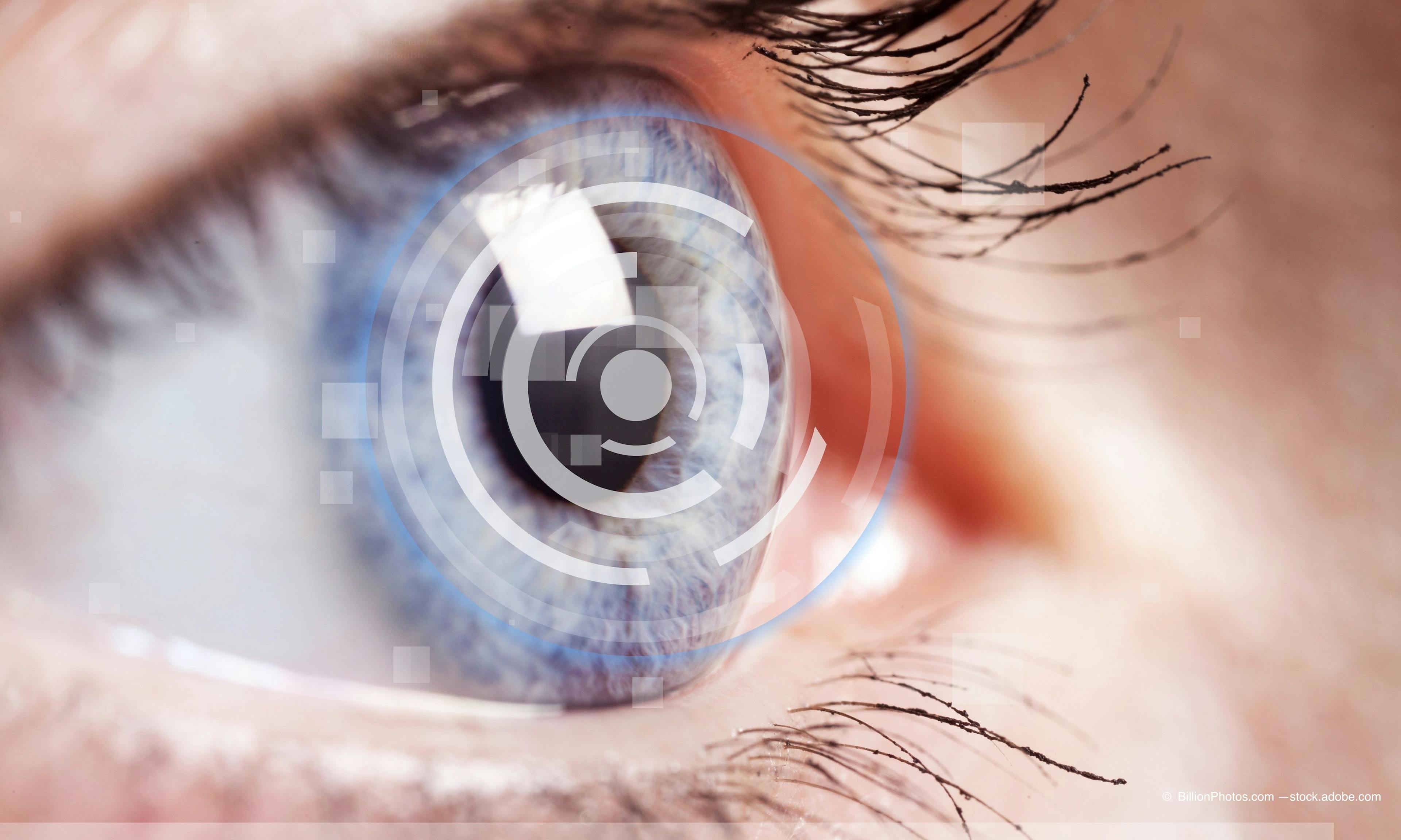 Physicians measure contrast sensitivity in patients with cataract
