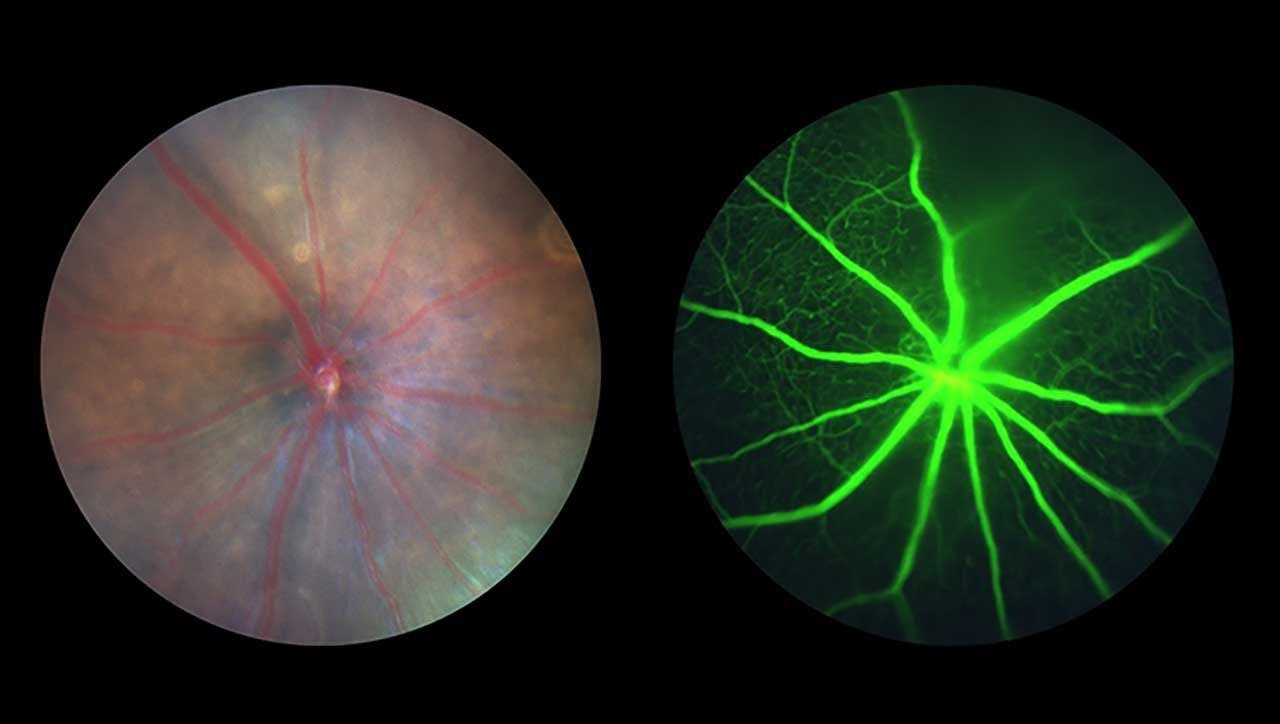 Taken with a specialized camera, images of a mouse retina before spaceflight (left) and a fluorescein angiogram, captured using a fluorescent dye, of the microvascular circulation of a mouse retina (right) are shown here. (Image credit: Oculogenex)