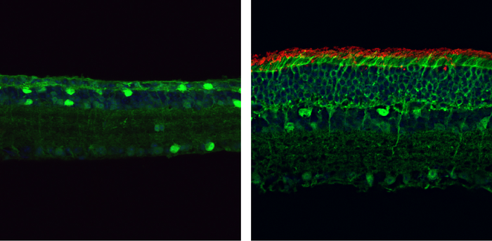 By the age of four months, the retinas of mice carrying a mutation in the gene encoding PDE6β (left) are thin and lack rod photoreceptors (red). But mice who have had this mutation corrected through the PESpRY system (right) have much thicker retinas containing numerous rod cells. (Image courtesy of Huan Qin et al)