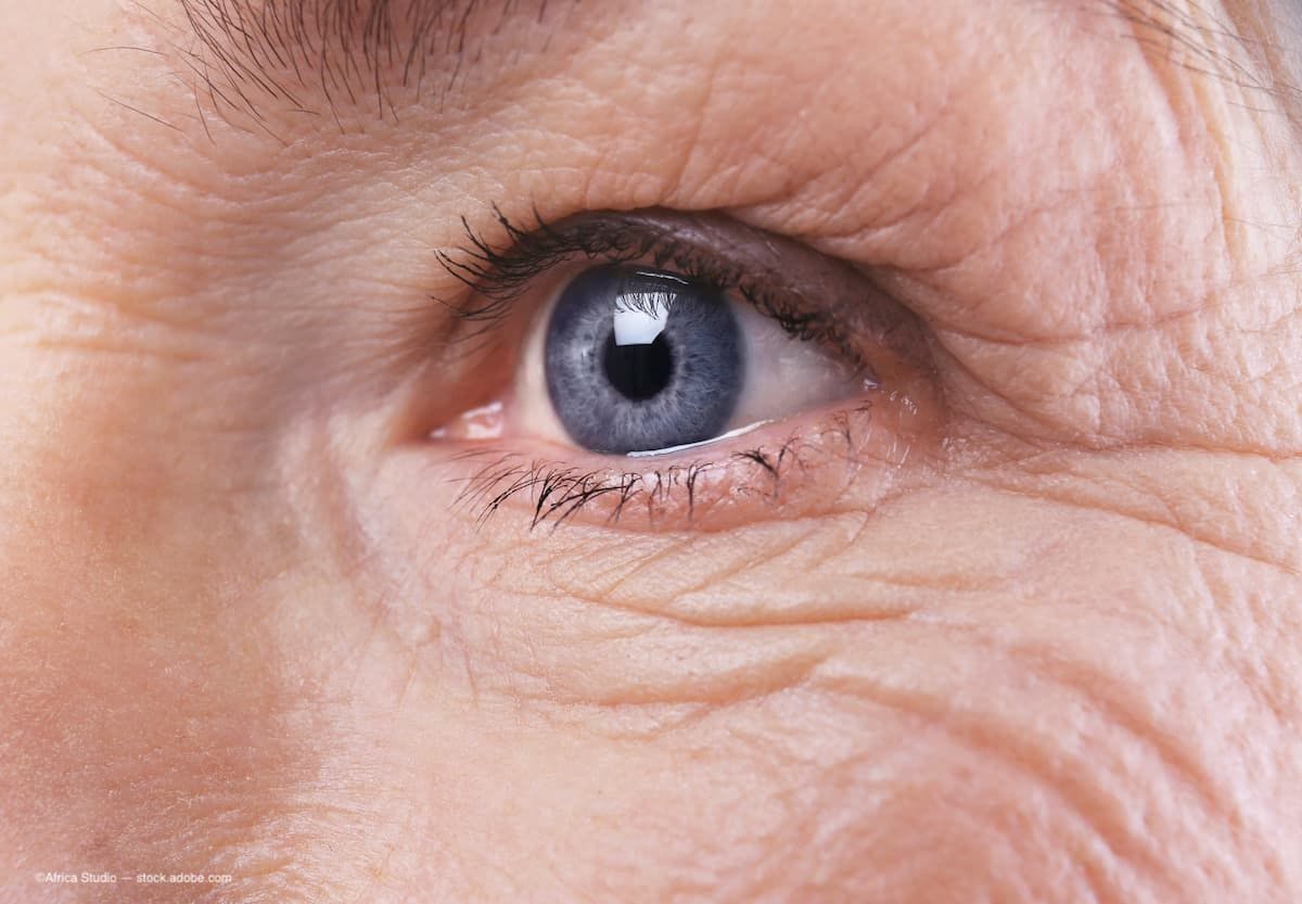 A close image of an elderly person's eyes. (Image Credit: AdobeStock/Africa Studio)