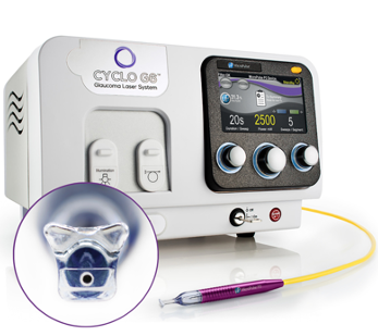 BLOG: MicroPulse® technology with Sweep software and revised MicroPulse P3 probe help provide more effective glaucoma treatments