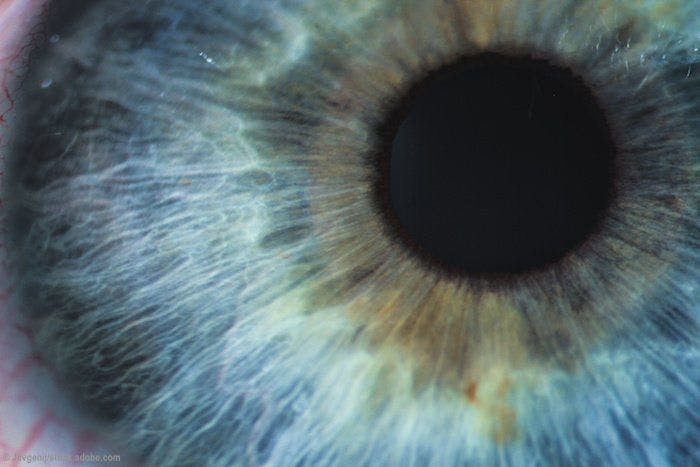 Pearls for building the corneal inlay patient base in your practice