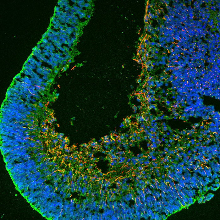 Cross-section of a retinal organoid, showing the location of different types of neurons such as ganglions (red) and Müller glia (green).