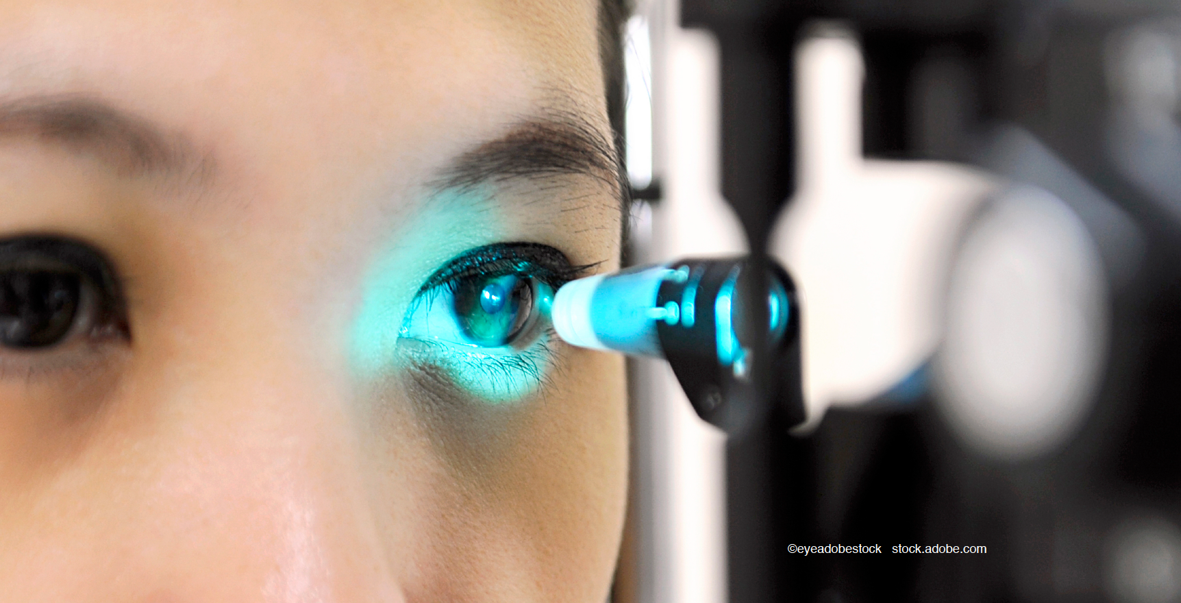 Novel devices, drugs driving expansion in glaucoma market