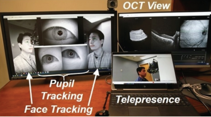 Robotically aligned OCT has potential for use in telemedicine