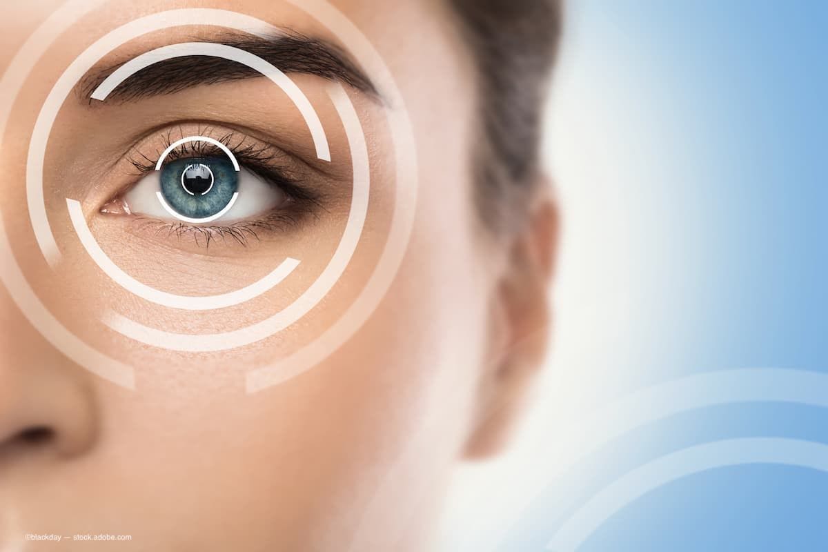 A woman with graphics over her eye simulating laser eye surgery. (Image Credit: AdobeStock/blackday)